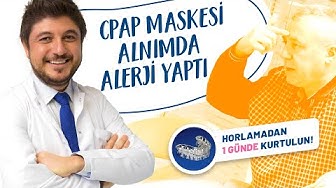 CPAP maskesi alnımda alerji yaptı